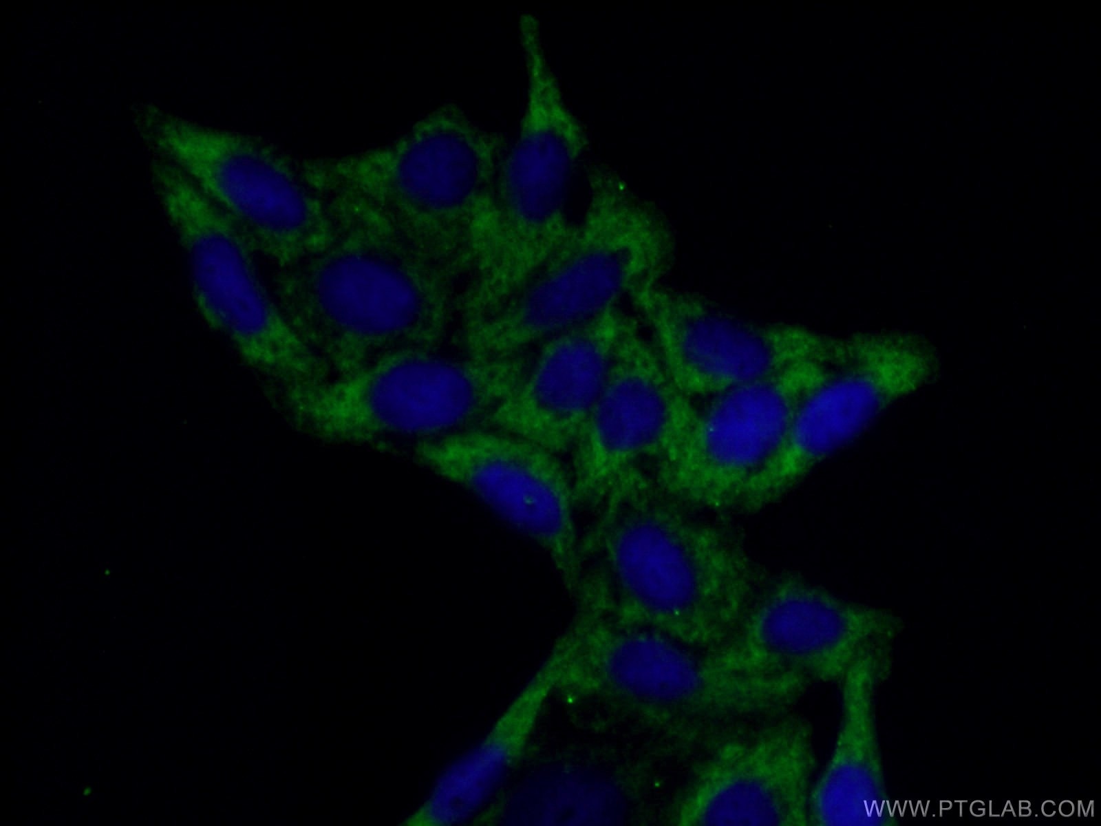 Arginase-1