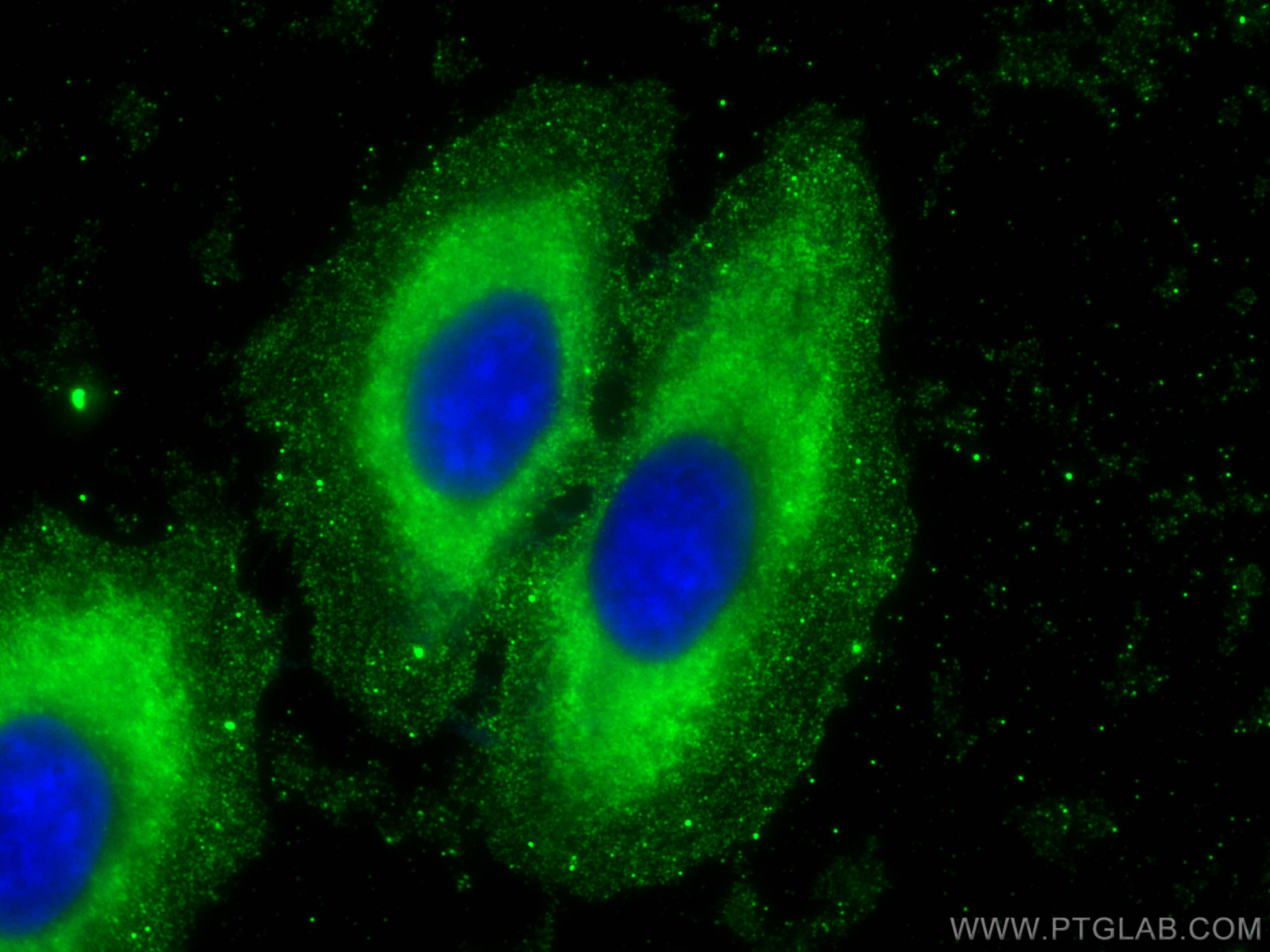 Immunofluorescence (IF) / fluorescent staining of HepG2 cells using Arginase-1 Monoclonal antibody (66129-1-Ig)