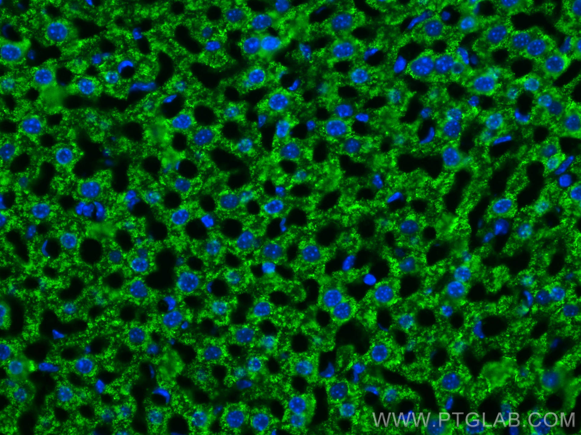 Immunofluorescence (IF) / fluorescent staining of mouse liver tissue using Arginase-1 Monoclonal antibody (66129-1-Ig)