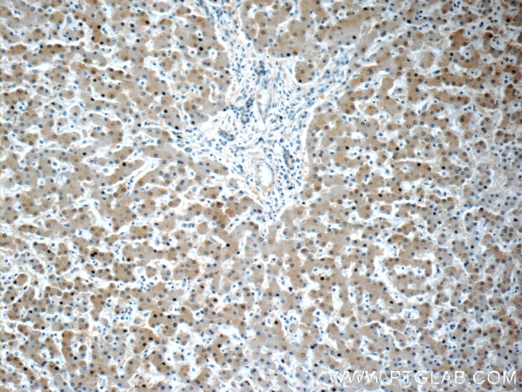 Immunohistochemistry (IHC) staining of human liver tissue using Arginase-1 Monoclonal antibody (66129-1-Ig)