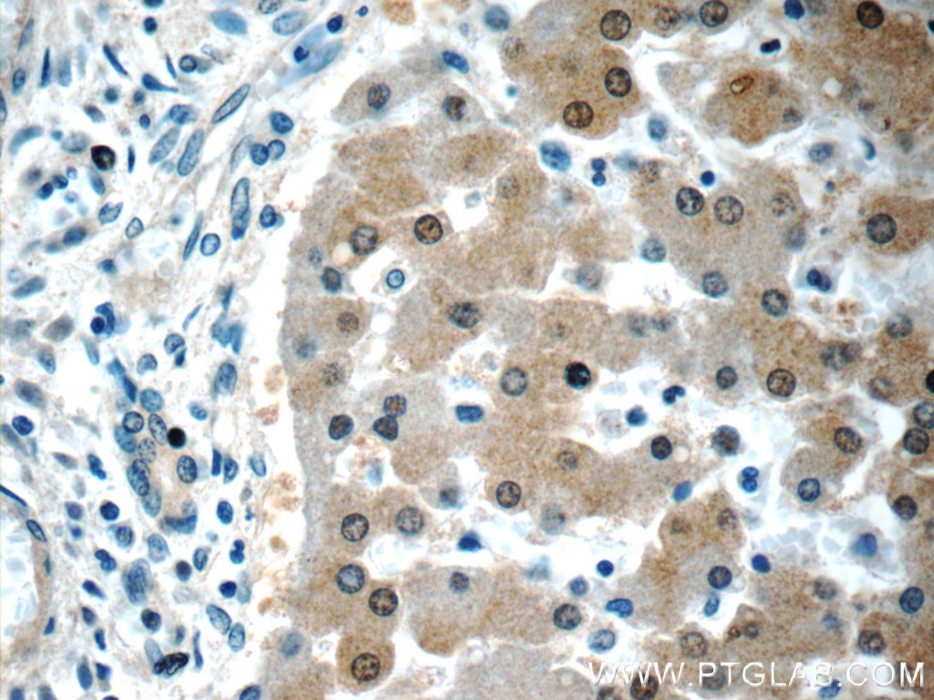 Immunohistochemistry (IHC) staining of human liver tissue using Arginase-1 Monoclonal antibody (66129-1-Ig)