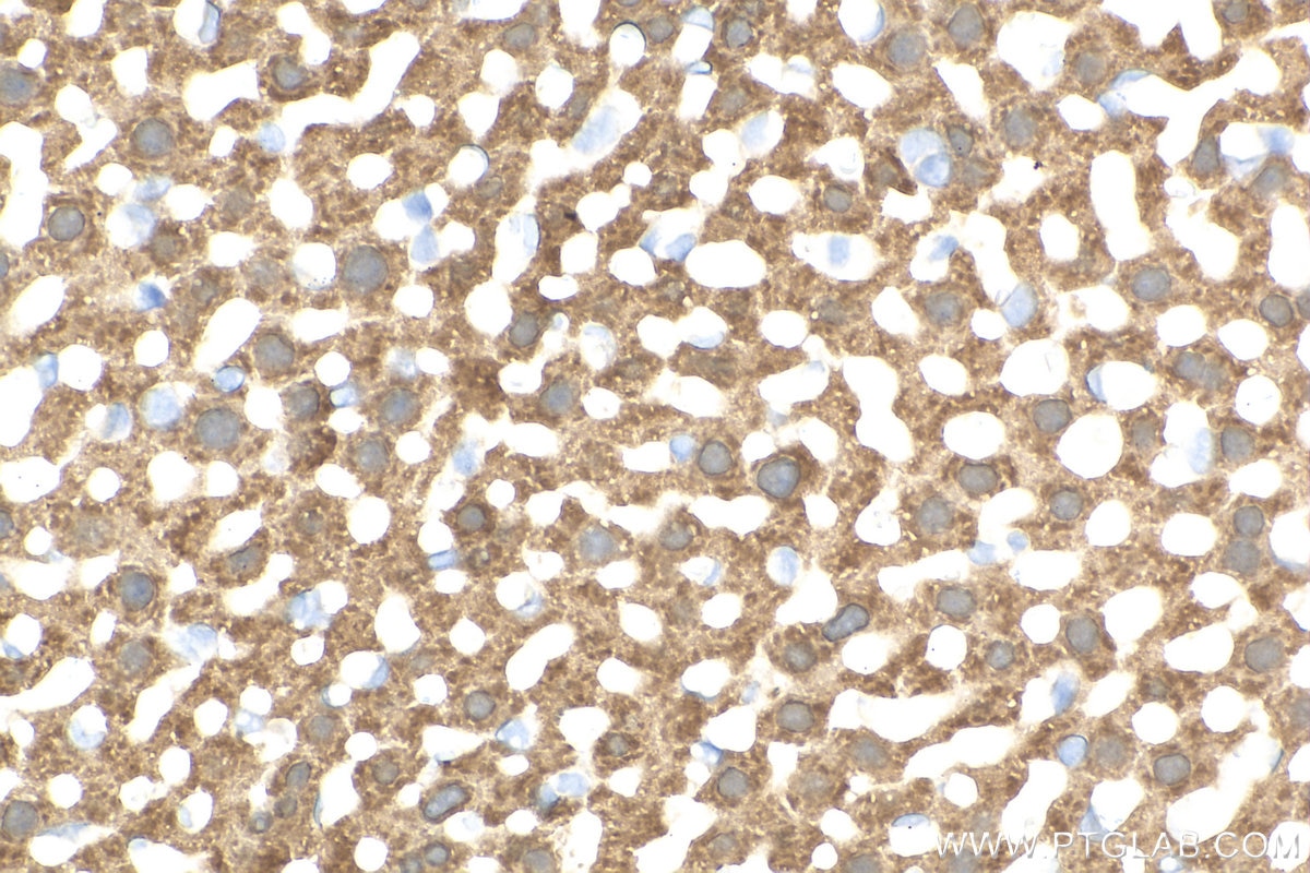 Immunohistochemistry (IHC) staining of mouse liver tissue using Arginase-1 Monoclonal antibody (66129-1-Ig)