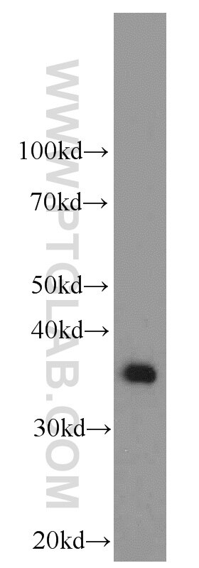 Arginase-1 Monoclonal antibody