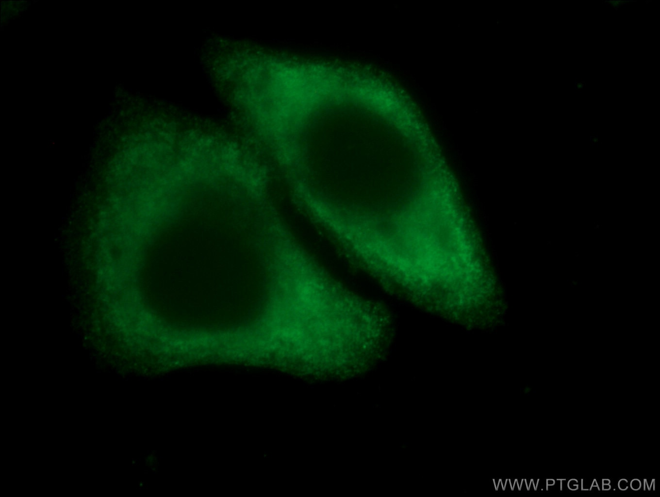 Immunofluorescence (IF) / fluorescent staining of HepG2 cells using CoraLite® Plus 488-conjugated Arginase-1 Monoclona (CL488-66129)