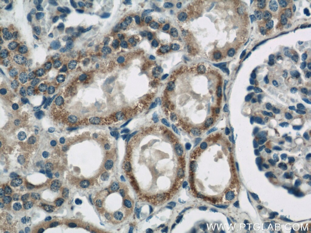 Immunohistochemistry (IHC) staining of human kidney tissue using ARG2 Polyclonal antibody (14825-1-AP)