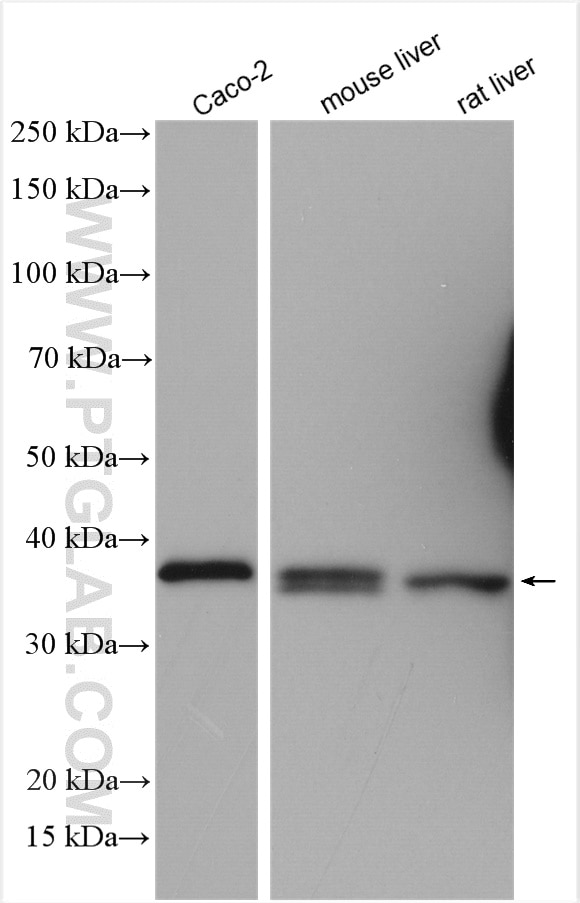 Western Blot (WB) analysis of various lysates using ARG2 Polyclonal antibody (14825-1-AP)