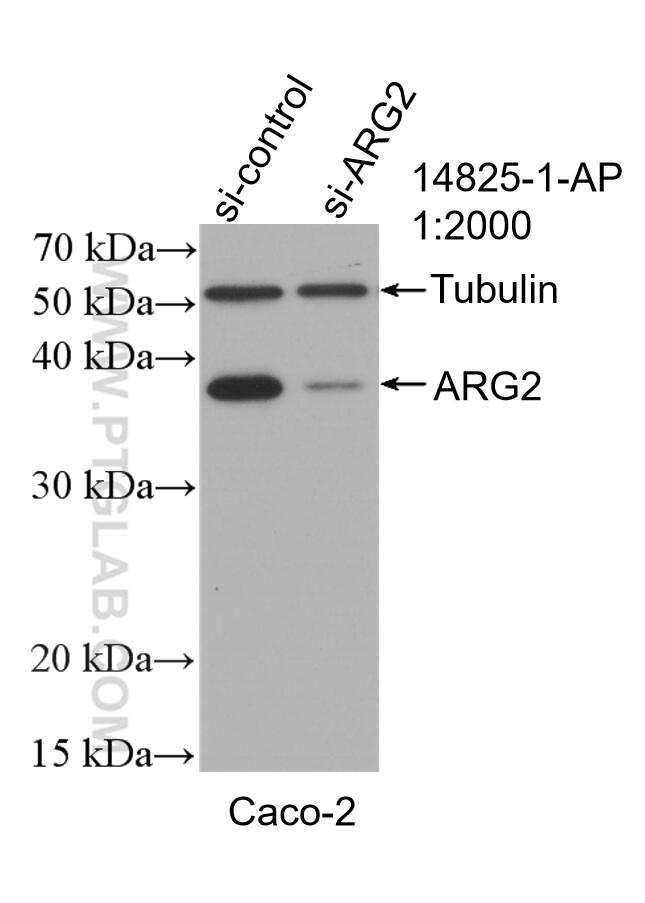 Western Blot (WB) analysis of Caco-2 cells using ARG2 Polyclonal antibody (14825-1-AP)
