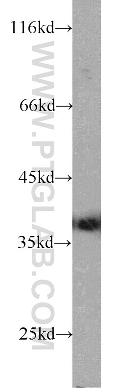 Western Blot (WB) analysis of HEK-293 cells using ARG2 Polyclonal antibody (14825-1-AP)