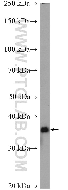ARGLU1