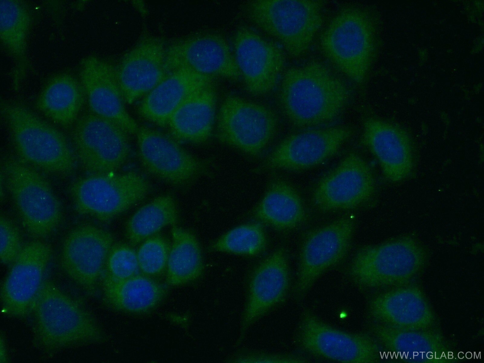 Immunofluorescence (IF) / fluorescent staining of HeLa cells using ARHGAP1 Polyclonal antibody (11169-1-AP)