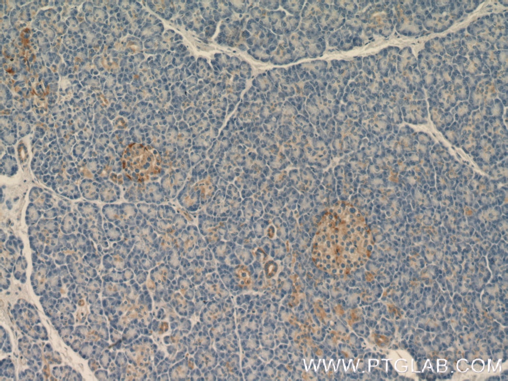 Immunohistochemistry (IHC) staining of human pancreas tissue using ARHGAP1 Polyclonal antibody (11169-1-AP)