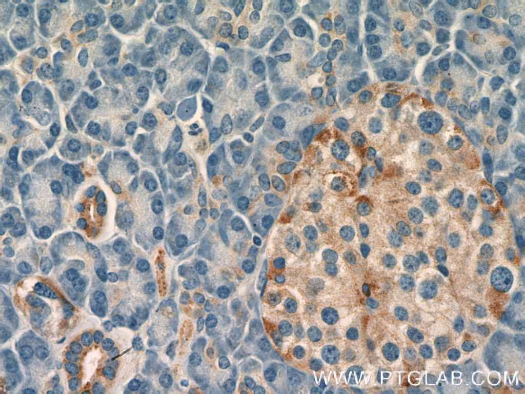 Immunohistochemistry (IHC) staining of human pancreas tissue using ARHGAP1 Polyclonal antibody (11169-1-AP)