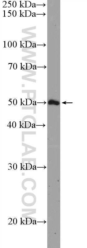 Western Blot (WB) analysis of RAW 264.7 cells using ARHGAP1 Polyclonal antibody (11169-1-AP)