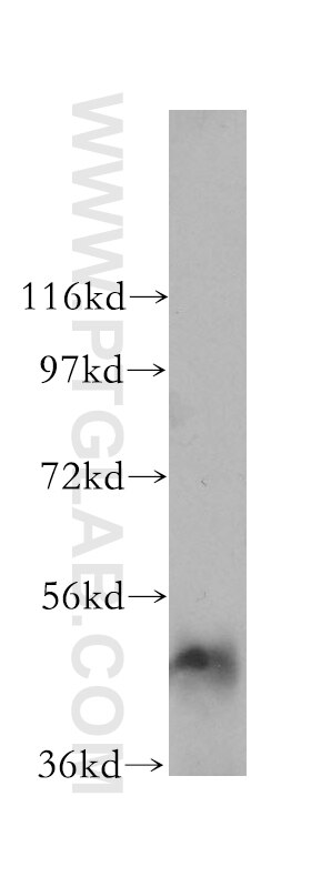 WB analysis of human duodenum using 11169-1-AP