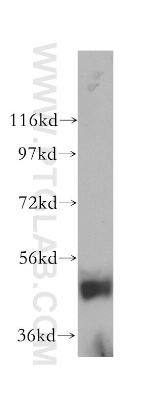 Western Blot (WB) analysis of human pancreas tissue using ARHGAP1 Polyclonal antibody (11169-1-AP)