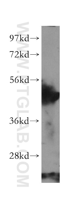 Western Blot (WB) analysis of human heart tissue using ARHGAP1 Polyclonal antibody (11169-1-AP)