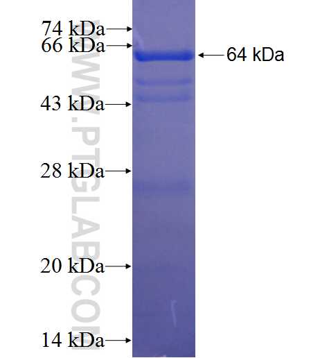 ARHGAP1 fusion protein Ag1651 SDS-PAGE