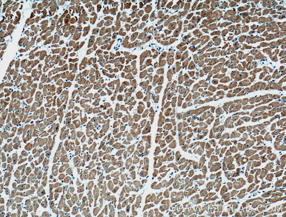 Immunohistochemistry (IHC) staining of human heart tissue using ARHGAP10 Polyclonal antibody (55139-1-AP)