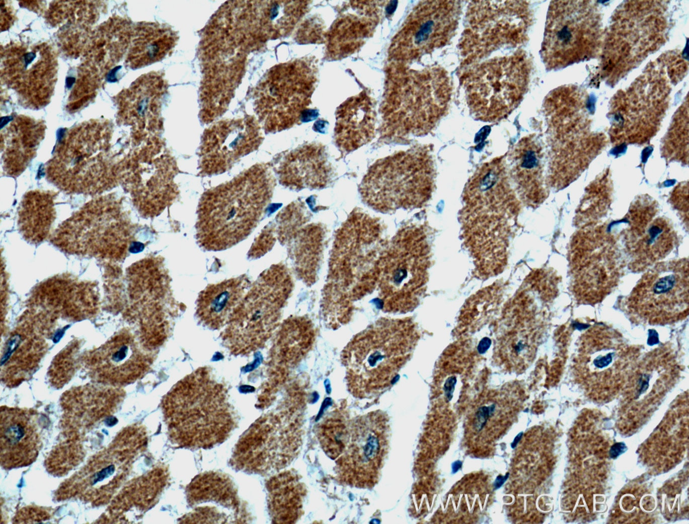 IHC staining of human heart using 55139-1-AP