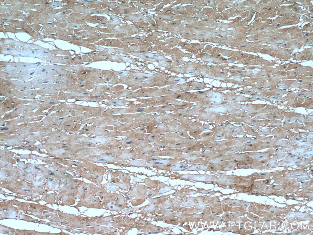 Immunohistochemistry (IHC) staining of human heart tissue using ARHGAP10 Polyclonal antibody (55139-1-AP)