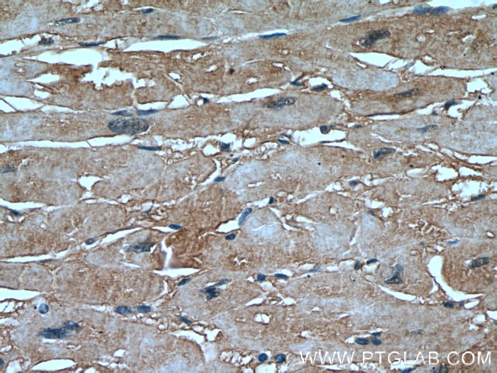 Immunohistochemistry (IHC) staining of human heart tissue using ARHGAP10 Polyclonal antibody (55139-1-AP)