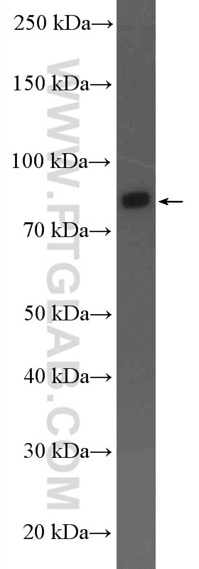 Western Blot (WB) analysis of mouse heart tissue using ARHGAP10 Polyclonal antibody (55139-1-AP)