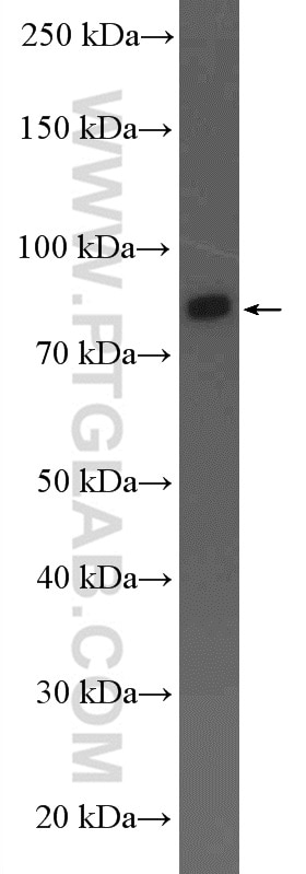 WB analysis of mouse heart using 55139-1-AP