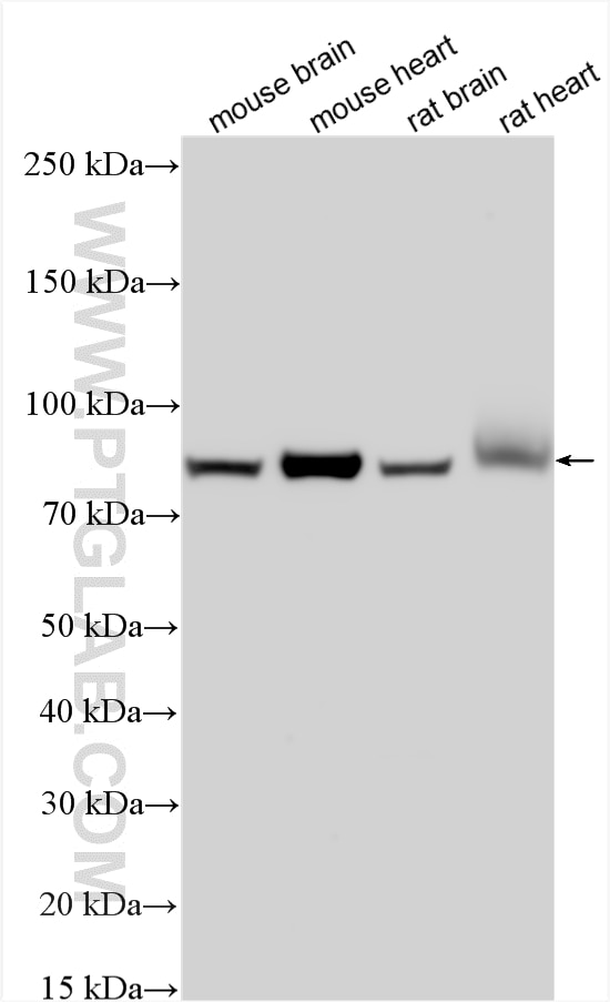 Western Blot (WB) analysis of various lysates using ARHGAP10 Polyclonal antibody (55139-1-AP)