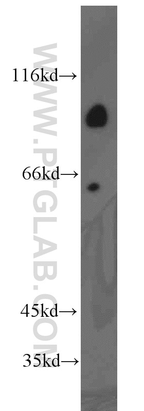 Western Blot (WB) analysis of human heart tissue using ARHGAP10 Polyclonal antibody (55139-1-AP)