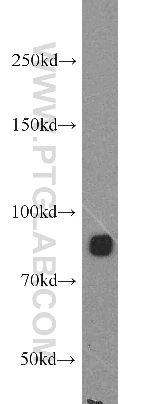 Western Blot (WB) analysis of mouse kidney tissue using ARHGAP10 Polyclonal antibody (55139-1-AP)