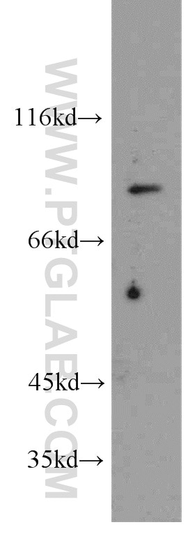 Western Blot (WB) analysis of HEK-293 cells using ARHGAP10 Polyclonal antibody (55139-1-AP)