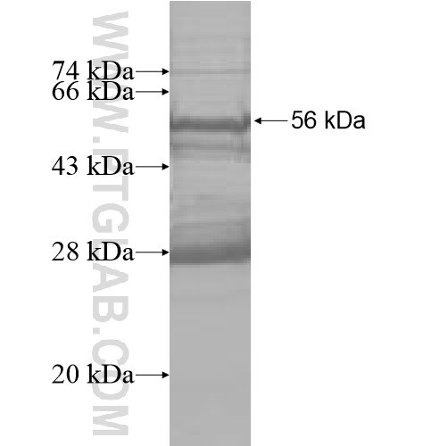 ARHGAP11B fusion protein Ag10155 SDS-PAGE