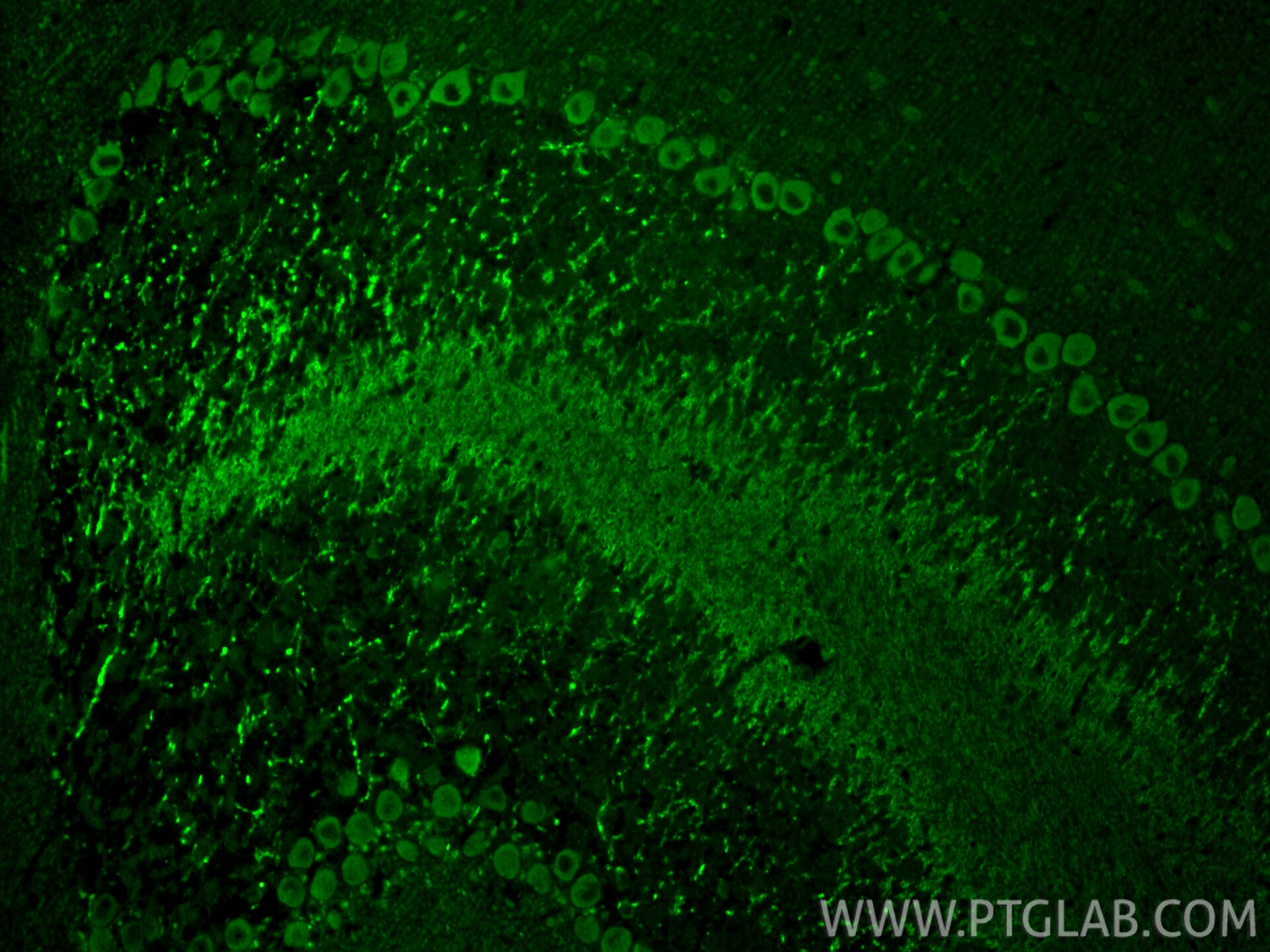 Immunofluorescence (IF) / fluorescent staining of mouse cerebellum tissue using ARHGAP12 Polyclonal antibody (17855-1-AP)