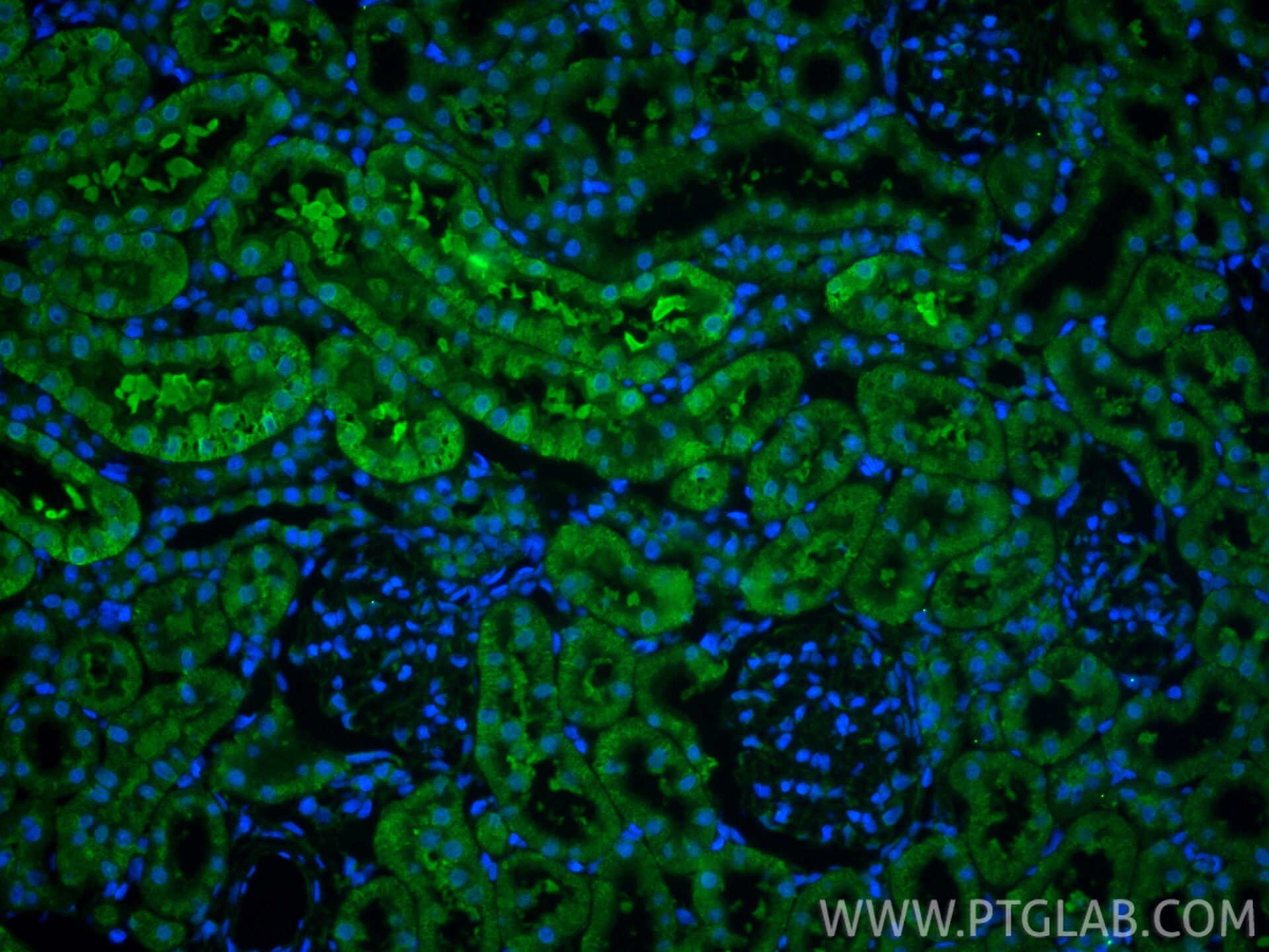 Immunofluorescence (IF) / fluorescent staining of rat kidney tissue using ARHGAP12 Polyclonal antibody (17855-1-AP)