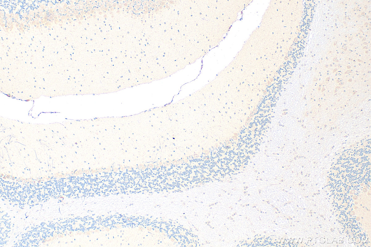 Immunohistochemistry (IHC) staining of mouse cerebellum tissue using ARHGAP12 Polyclonal antibody (17855-1-AP)