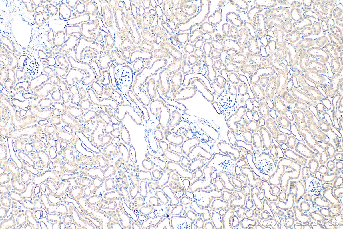 Immunohistochemistry (IHC) staining of mouse kidney tissue using ARHGAP12 Polyclonal antibody (17855-1-AP)