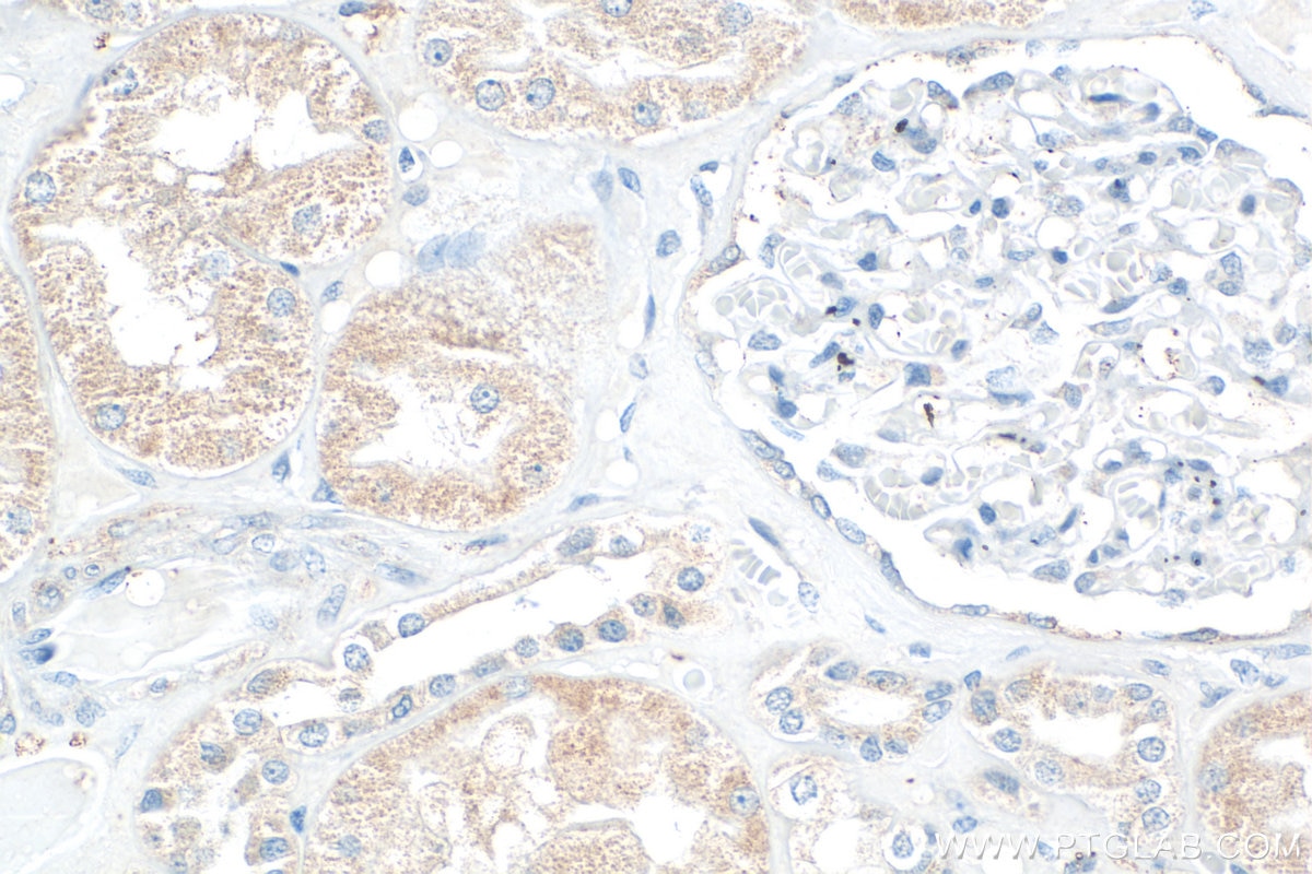 Immunohistochemistry (IHC) staining of human kidney tissue using ARHGAP12 Polyclonal antibody (17855-1-AP)
