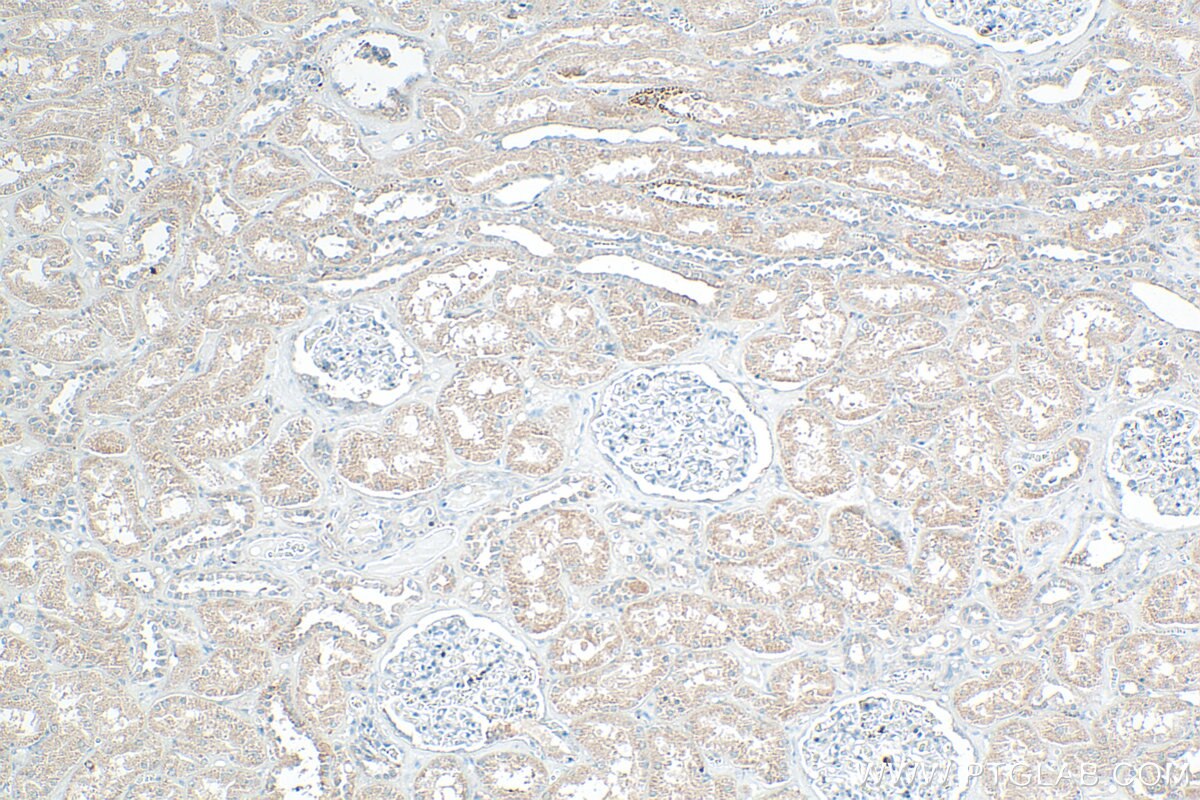 Immunohistochemistry (IHC) staining of human kidney tissue using ARHGAP12 Polyclonal antibody (17855-1-AP)