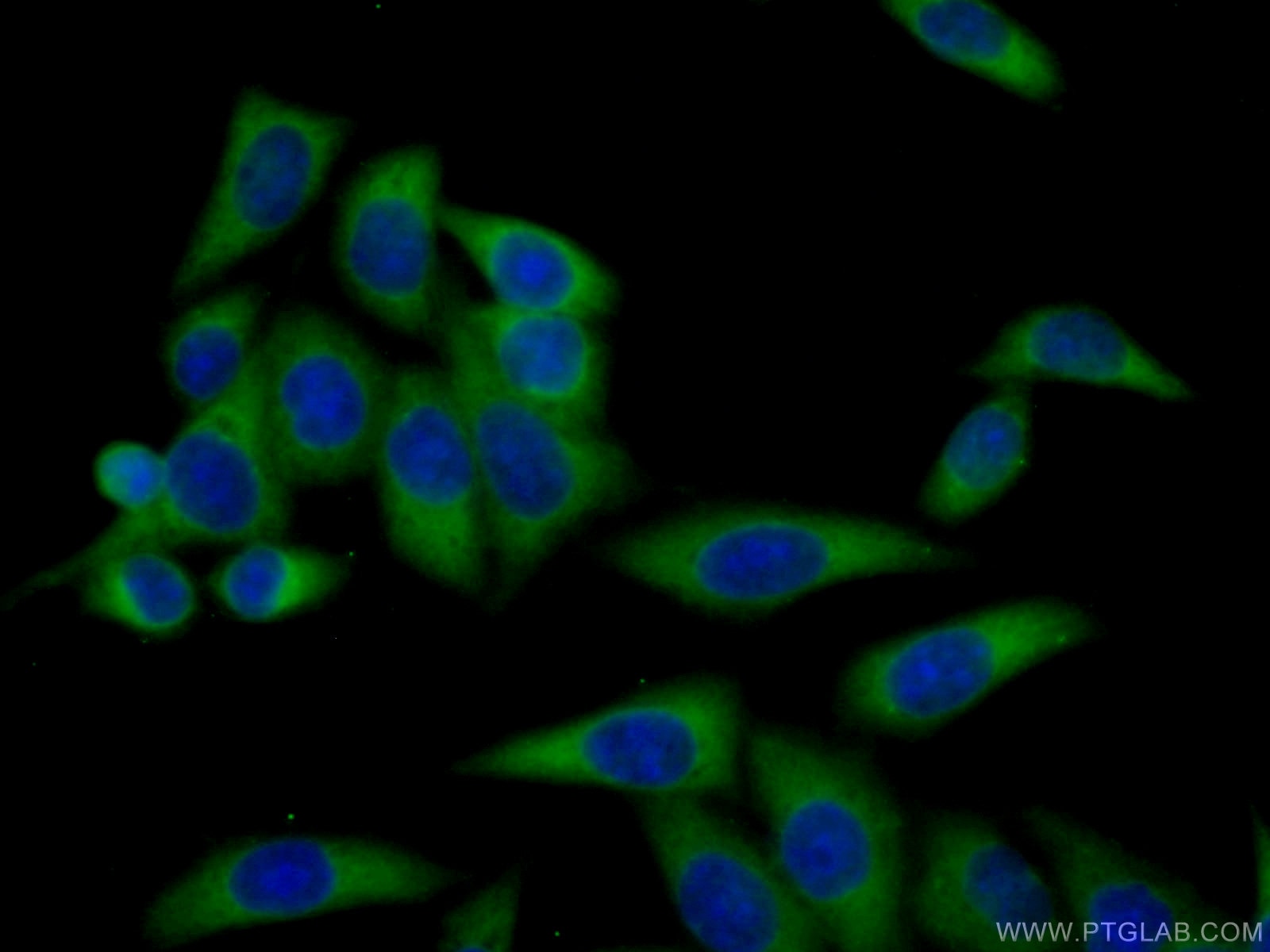 Immunofluorescence (IF) / fluorescent staining of HeLa cells using ARHGAP18 Polyclonal antibody (28409-1-AP)