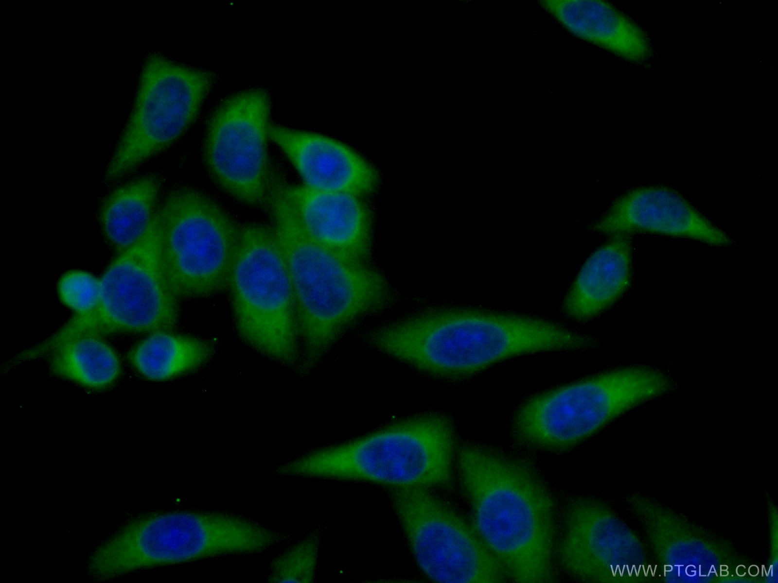 IF Staining of HeLa using 28409-1-AP