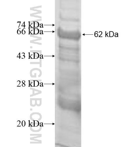 ARHGAP18 fusion protein Ag10152 SDS-PAGE