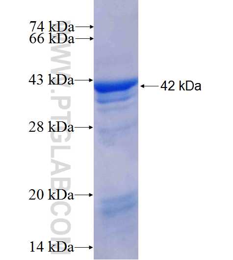 ARHGAP18 fusion protein Ag10202 SDS-PAGE
