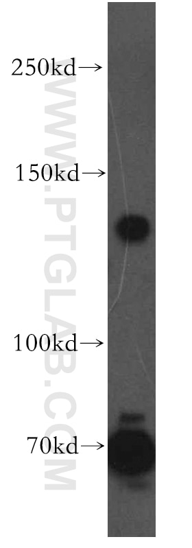 Western Blot (WB) analysis of human brain tissue using ARHGAP20 Polyclonal antibody (13775-1-AP)