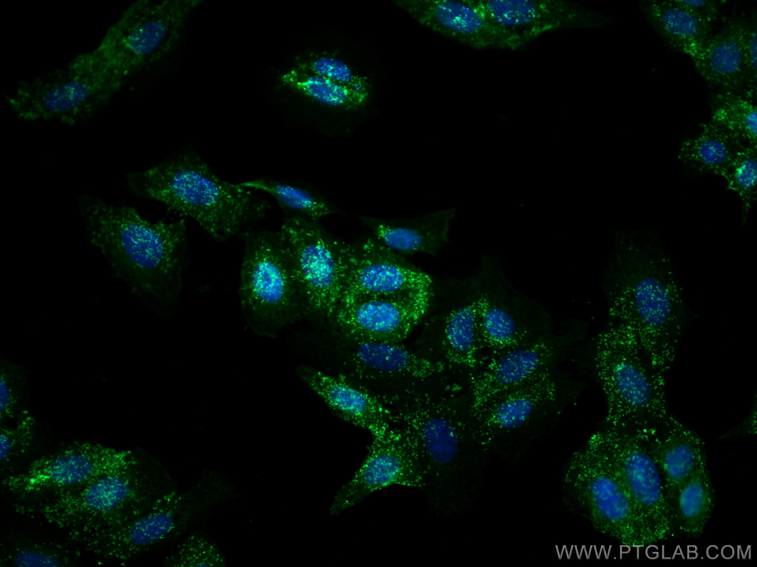 Immunofluorescence (IF) / fluorescent staining of HepG2 cells using ARHGAP21 Polyclonal antibody (22183-1-AP)