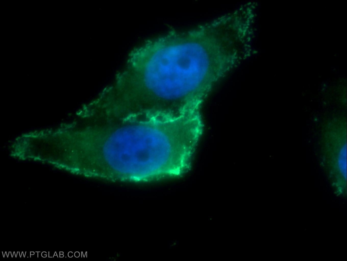 Immunofluorescence (IF) / fluorescent staining of HepG2 cells using ARHGAP21 Polyclonal antibody (22183-1-AP)