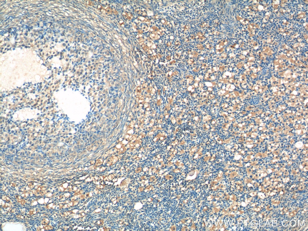 Immunohistochemistry (IHC) staining of human ovary tissue using ARHGAP21 Polyclonal antibody (22183-1-AP)