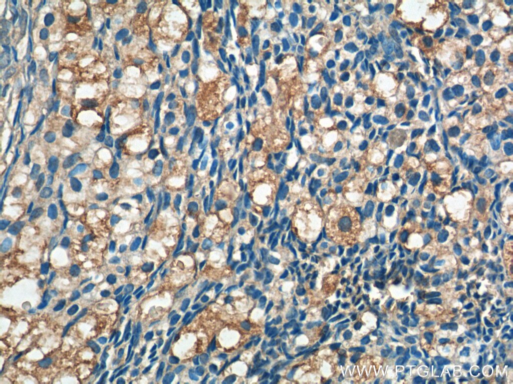 Immunohistochemistry (IHC) staining of human ovary tissue using ARHGAP21 Polyclonal antibody (22183-1-AP)