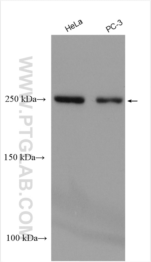 Western Blot (WB) analysis of various lysates using ARHGAP21 Polyclonal antibody (22183-1-AP)