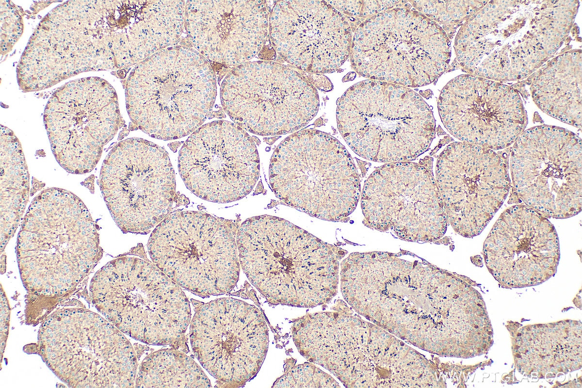 Immunohistochemistry (IHC) staining of mouse testis tissue using ARHGAP23 Polyclonal antibody (31938-1-AP)