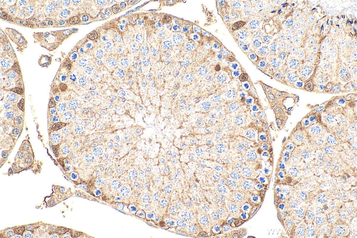 Immunohistochemistry (IHC) staining of mouse testis tissue using ARHGAP23 Polyclonal antibody (31938-1-AP)